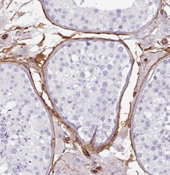 TEX264 antibody|TEX264抗体