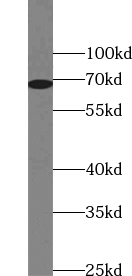 ZNF410 antibody|ZNF410抗体