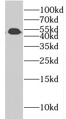 CSTF1 antibody|CSTF1抗体 FNab020