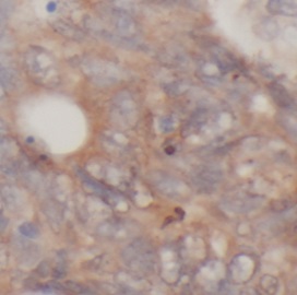 CYP27A1 antibody|CYP27A1抗体 FNa