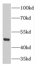 GTPBP3 antibody|GTPBP3抗体