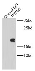 HDAC6 antibody|HDAC6抗体 FNab038