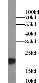 CLDN3 antibody|CLDN3抗体