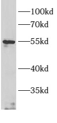 ARMC5 antibody|ARMC5抗体