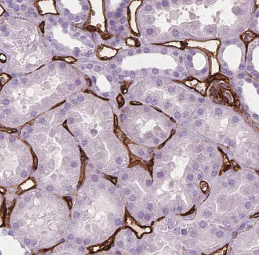 ACOT13 antibody|ACOT13抗体