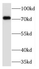 TCF12 antibody|TCF12抗体