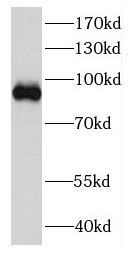DDX27 antibody|DDX27抗体