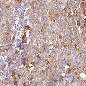 NUDT11 antibody|NUDT11抗体