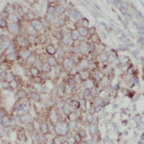 TPD52L2 antibody|TPD52L2抗体