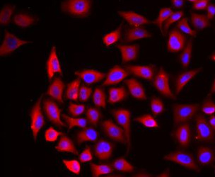COCH antibody|COCH抗体