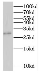 IFI30 antibody|IFI30抗体
