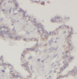 LGALS3 antibody|LGALS3抗体 FNab0