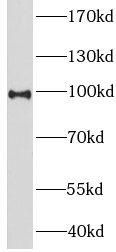 LHCGR antibody|LHCGR抗体