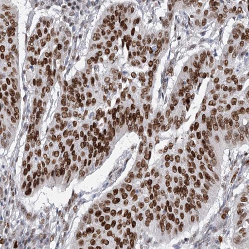 PPP2R5E antibody|PPP2R5E抗体