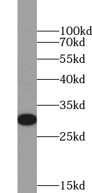 UPK2 antibody|UPK2抗体 FNab09274