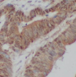 ABCA4 antibody|ABCA4抗体 FNab100