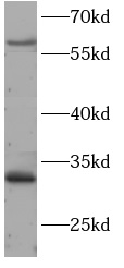 HSF2 antibody|HSF2抗体 FNab10025