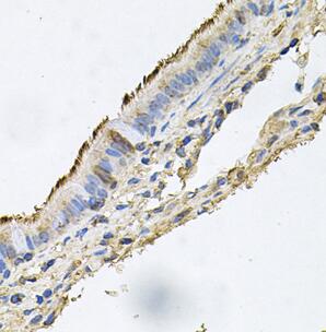 DSG1 antibody|DSG1抗体