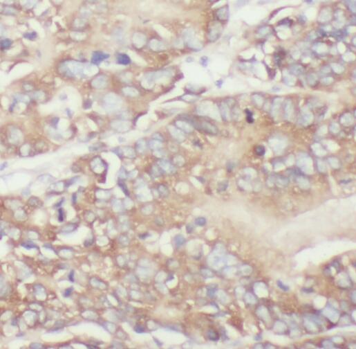 TPK1 antibody|TPK1抗体