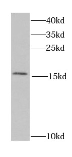 RBP2 antibody|RBP2抗体