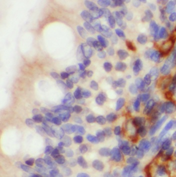 PLP2 antibody|PLP2抗体