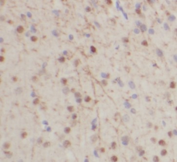 TH antibody|TH抗体 FNab08655