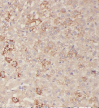 HAS3 antibody|HAS3抗体 FNab03760