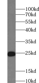 cTnI antibody|cTnI抗体 FNab01273