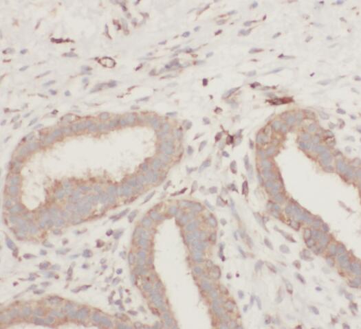 S100A9 antibody|S100A9抗体