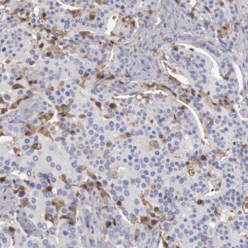 PMEPA1 antibody|PMEPA1抗体