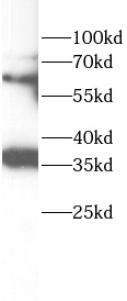 PTPN6 antibody|PTPN6抗体 FNab107