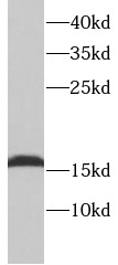 TNNC1 antibody|TNNC1抗体
