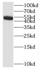 IL17RC antibody|IL17RC抗体