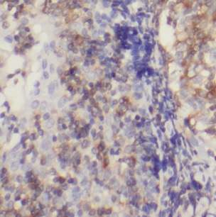 BCL11A antibody|BCL11A抗体