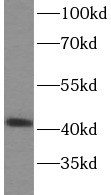 SPOP antibody|SPOP抗体