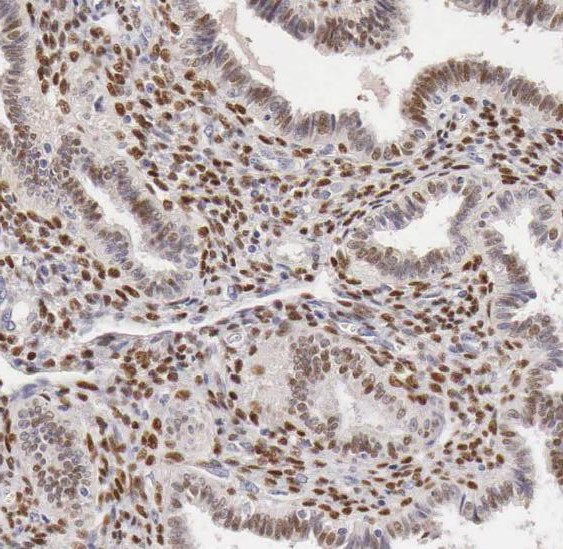 SF3A2 antibody|SF3A2抗体