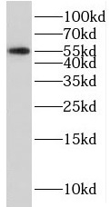 SERPINI2 antibody|SERPINI2抗体
