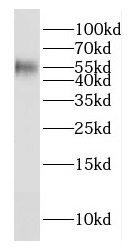 E2F1 antibody|E2F1抗体