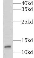 LSM7 antibody|LSM7抗体
