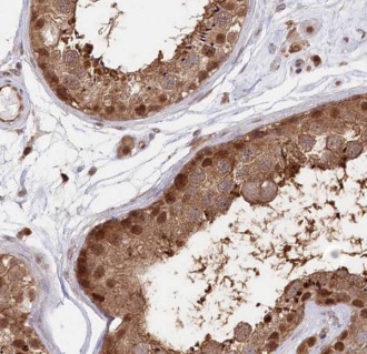 AKAP3 antibody|AKAP3抗体 FNab002