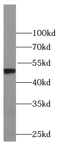 TDP2 antibody|TDP2抗体