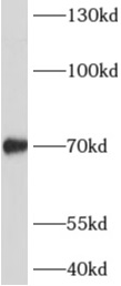 ADAMTSL4 antibody|ADAMTSL4抗体