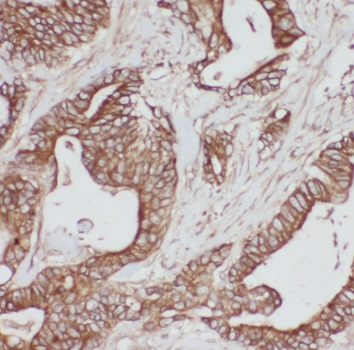 PSMB7 antibody|PSMB7抗体