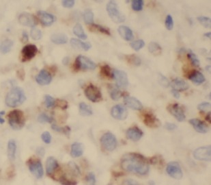 S100A8 antibody|S100A8抗体 FNab0