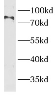 BBS10 antibody|BBS10抗体