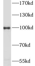HSP90AA1 antibody|HSP90AA1抗体 F