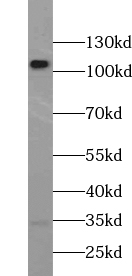 USP11 antibody|USP11抗体 FNab093