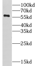CHST10 antibody|CHST10抗体