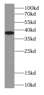 NPM1 antibody|NPM1抗体 FNab00759