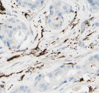 GRN antibody|GRN抗体 FNab03631